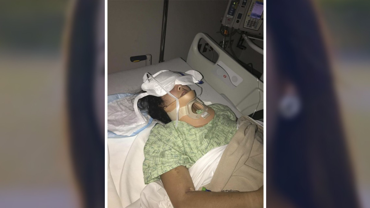 Chica sufre accidente tras realizar el "KikiChallenge"