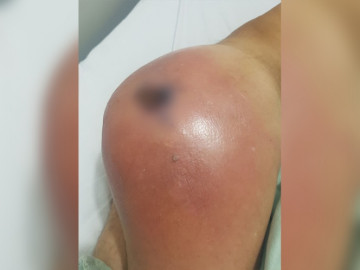 Hombre mata con sustancia "mágica" a persona en Oaxaca