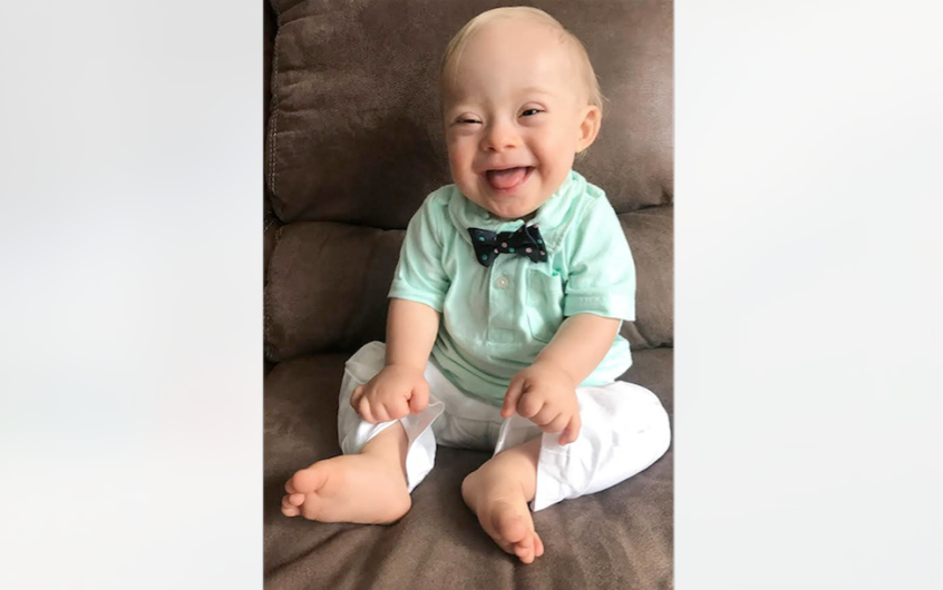 Lucas, el bebé con síndrome de Down que será la nueva imagen de Gerber