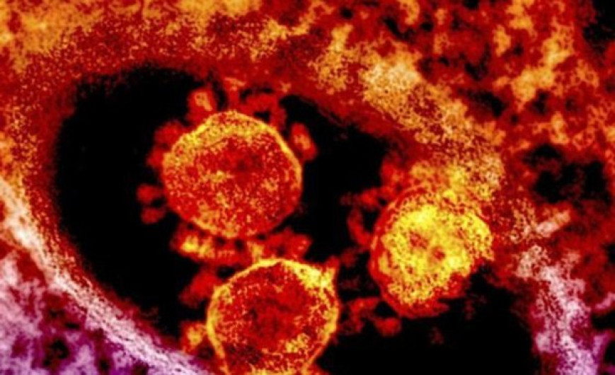 Detecta Tailandia segundo caso de coronavirus surgido en China