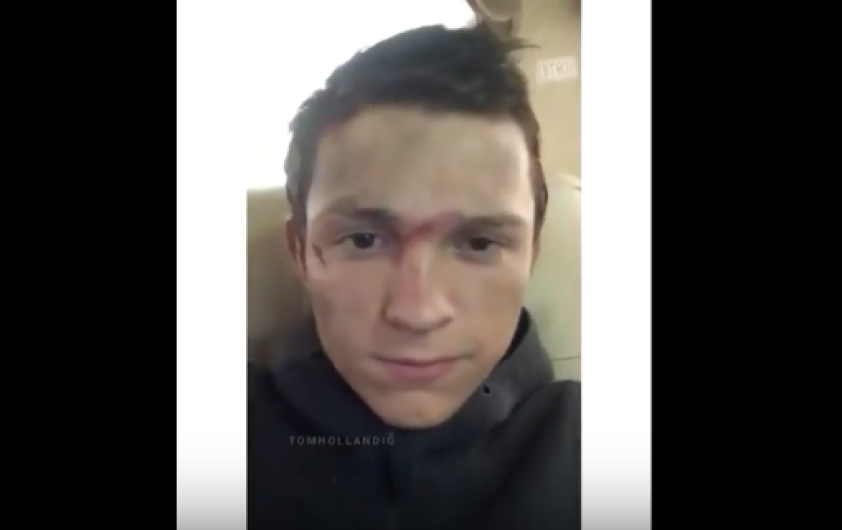 Spider-Man sufre accidente y se rompe la nariz