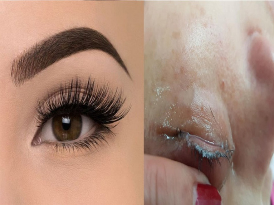 Va por pestañas postizas y le pegan los párpados