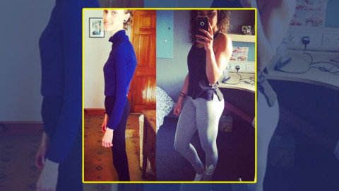 Chica muestra su recuperación tras anorexia