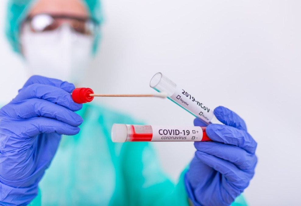 Fallas en sistema de salud deja sin contabilizar 300 mil pruebas de covid-19 en California