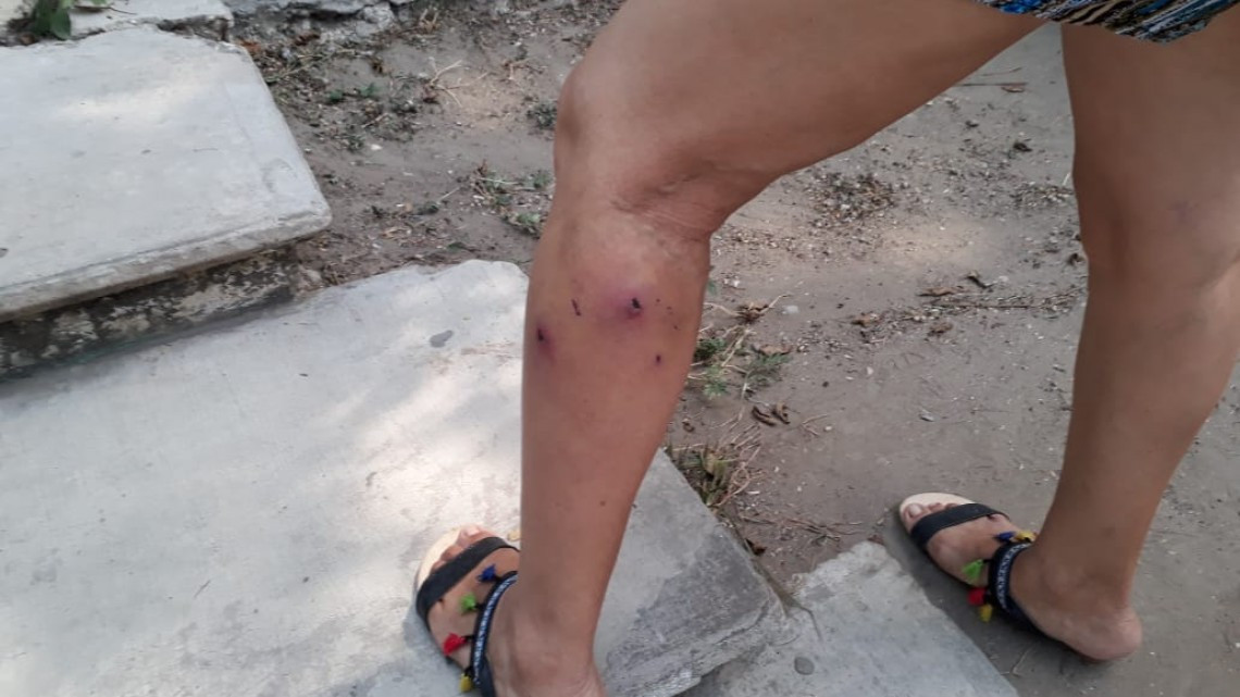 Se dispara ataque de perros a seres humanos, durante temporada de calor.