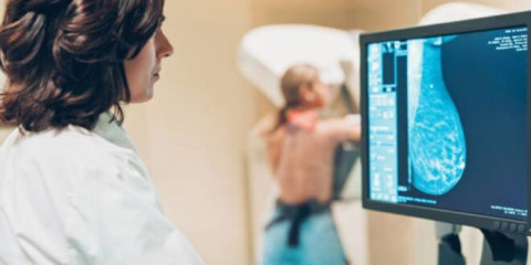 Presentan Modelo de Atención Universal para el Cáncer de Mama en México; habrá tratamiento sin importar derechohabiencia