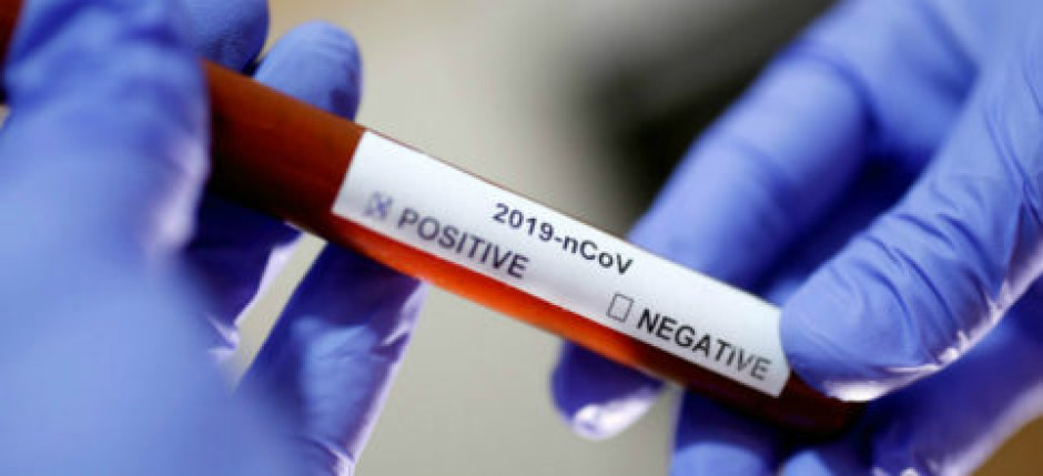 Confirman caso de COVID-19 en Michigan, portadores habrían viajado a la Isla del Padre Sur 