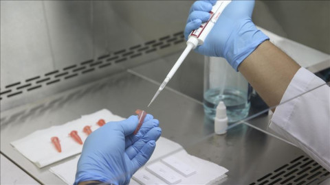 Johnson y Johnson prepara ensayo masivo de su vacuna contra COVID-19 