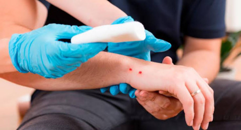 Confirman contagio de rabia en niños mordidos por murciélagos en Oaxaca