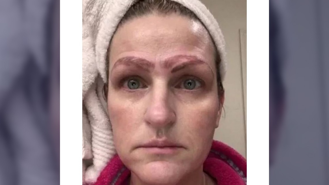 Por error en microblanding, termina con 4 cejas