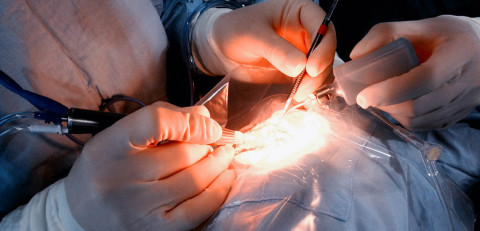 Mantienen campaña de cirugía de Pterigion 