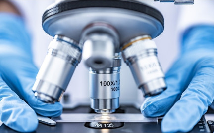 Se confirma primer caso de viruela del mono en EEUU 