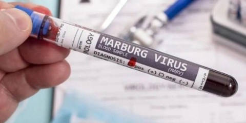 Guinea Ecuatorial confirma 8 casos más del virus de Marburgo