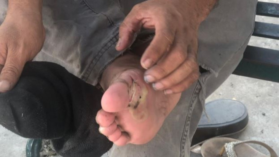 Migrante llega a Reynosa con heridas tras 60 horas de caminata 
