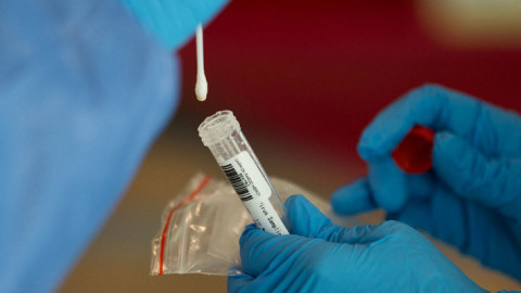 Canadá confirma los primeros contagios de variante ómicron