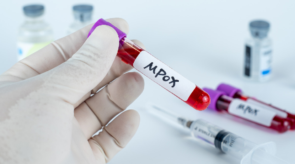 Mpox no puede considerarse el nuevo Covid: OMS