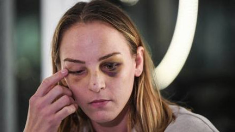 Absuelven en Francia a un entrenador de judo, acusado de agredir a su pareja