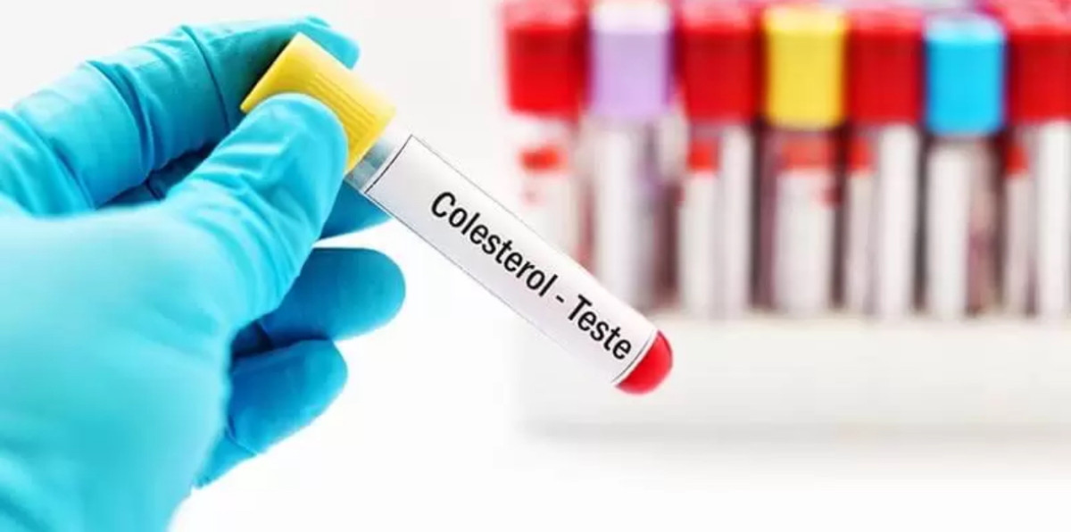 Colesterol alto: 4 de cada 10 mexicanos lo padecen; el riesgo es infarto cerebral