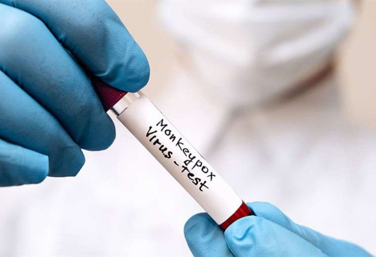 China confirma el primer caso de viruela del mono