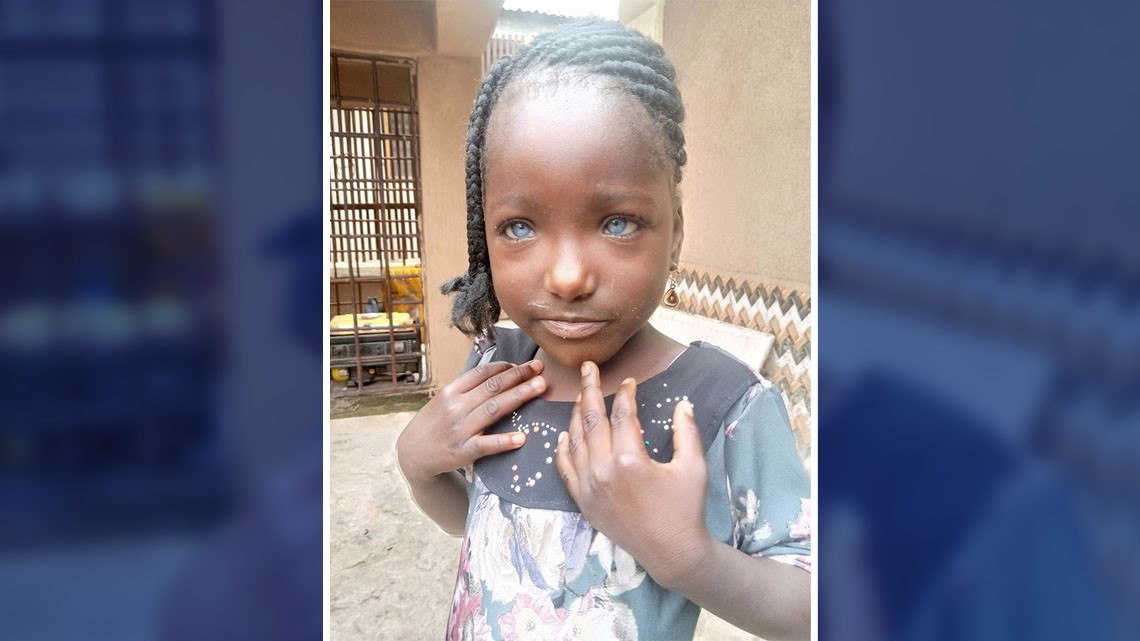 Por esta condición, hombre abandona a su esposa y a sus hijas