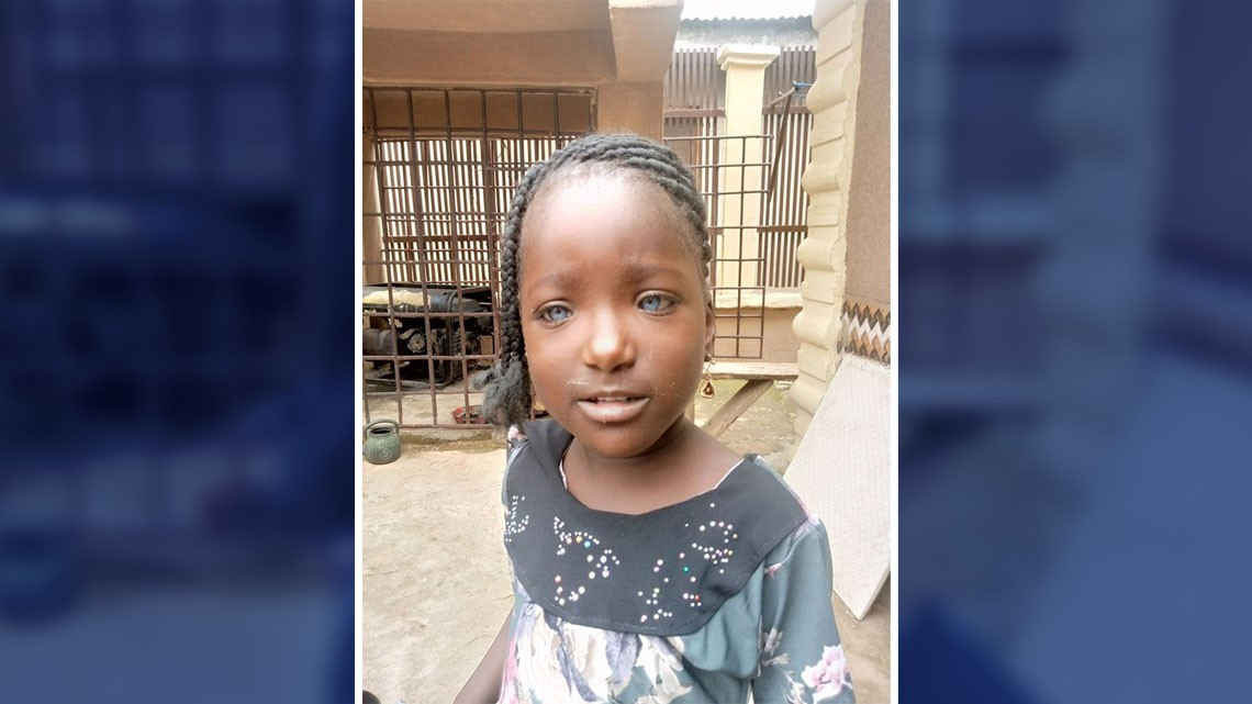 Por esta condición, hombre abandona a su esposa y a sus hijas