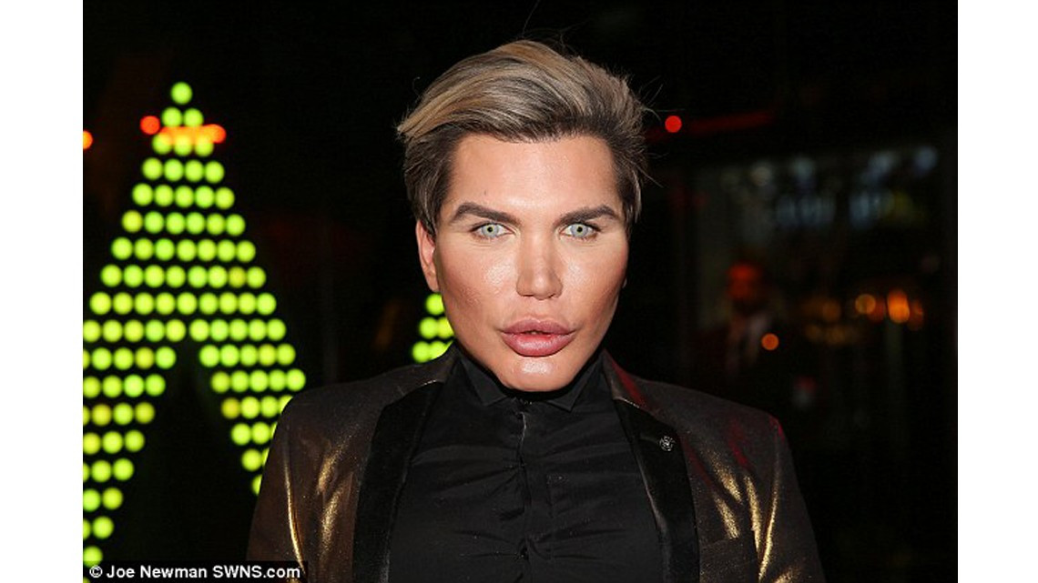 El "Ken humano" tiene complicaciones para respirar