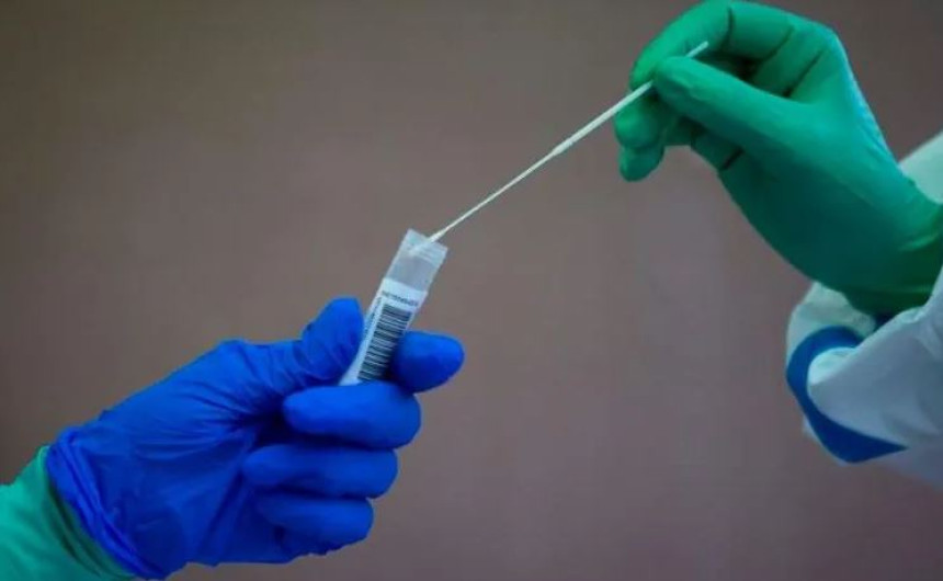 Disminuyen considerablemente las pruebas de COVID-19 en EU 