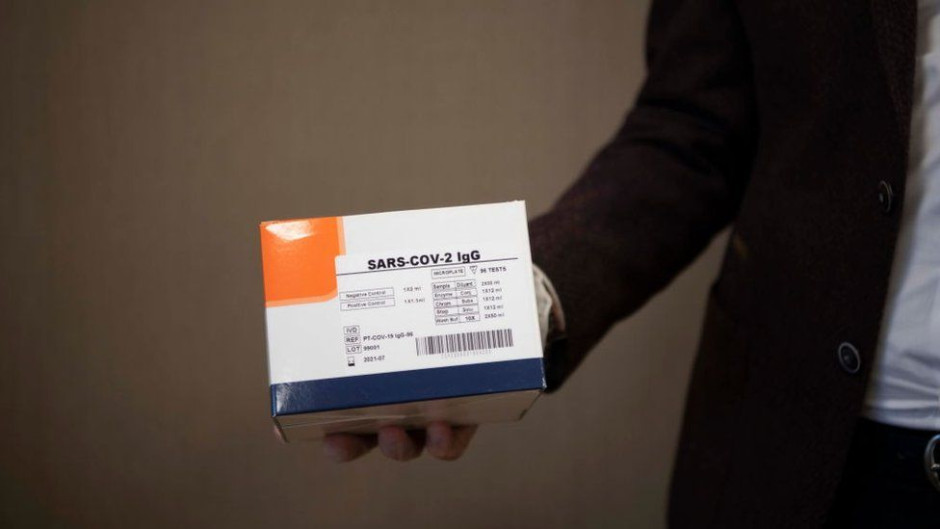 Establecen protocolo para evaluación de pruebas serológicas IgG e IgM para COVID-19