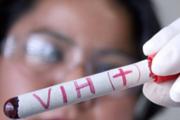 Tres mujeres son diagnósticadas con VIH por "faciales vampiro" en EUA