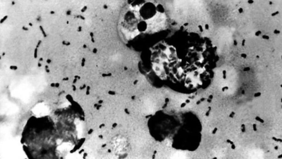 Confirma condado de California, primer caso de peste bubónica en 5 años