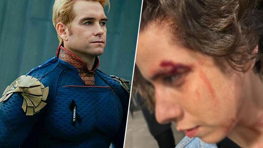 Detienen a Antony Starr, protagonista de ‘The Boys’ en España