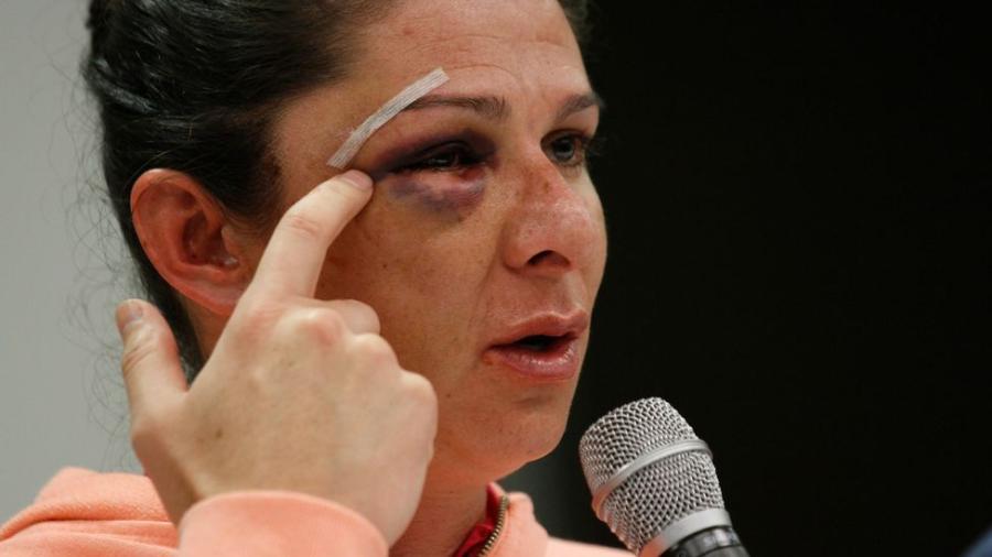 Juez ordena prisión al agresor de Ana Guevara