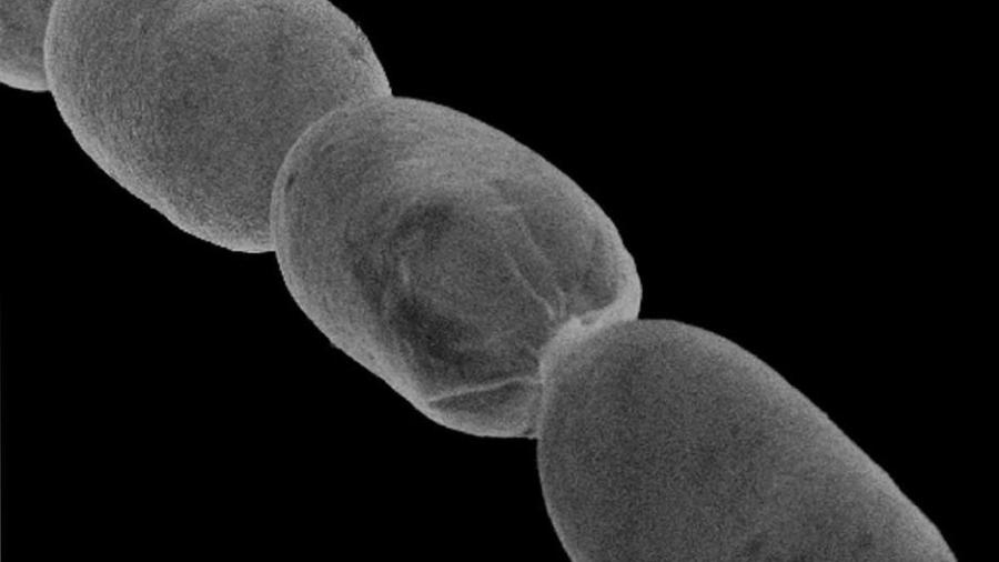 Se descubre bacteria gigante 