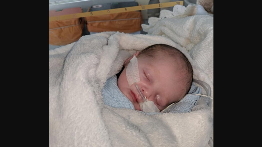 Notigape Bebe Se Enferma De Herpes Por Un Beso