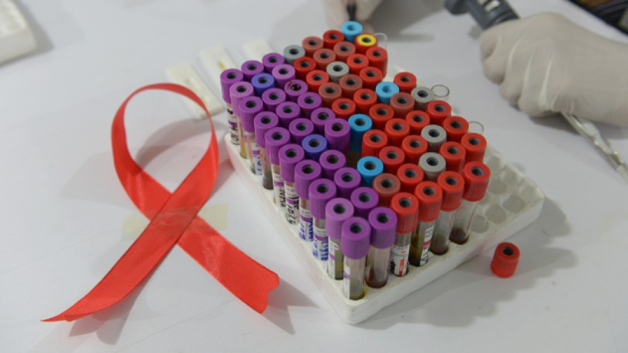 Paciente de Londres, segundo en vencer al VIH