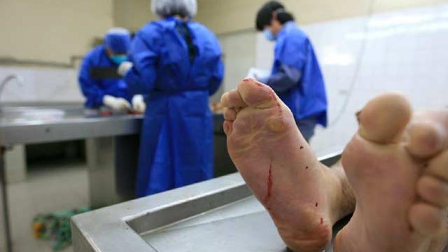 Suspenden de funciones a Perito M&eacute;dico