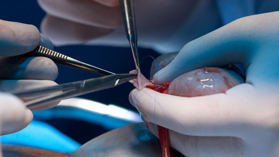 Médicos del Seguro Social realizan transplantes renales en 72 horas