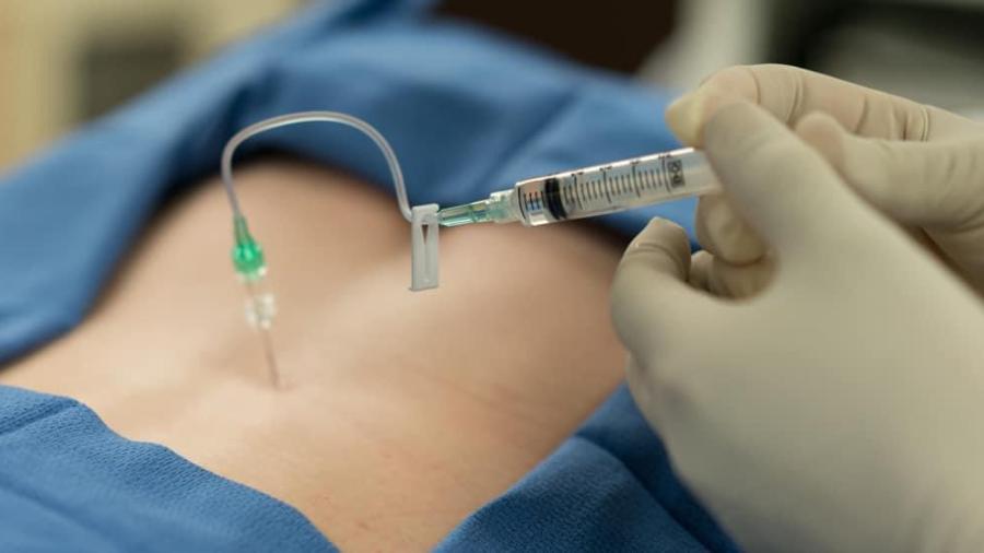 Coepris Reynosa en alerta en hospitales ante sospechas de meningitis