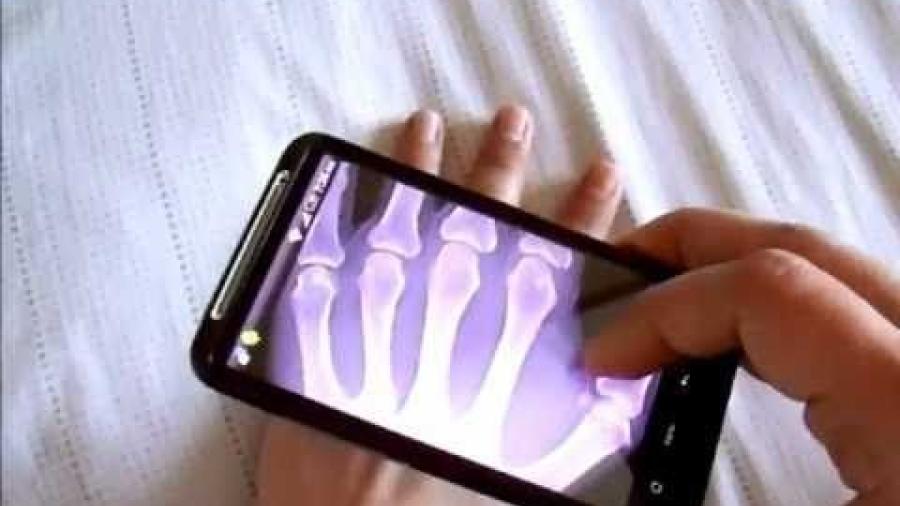 Tecnología permitirá a celulares ver a través de la piel o paredes