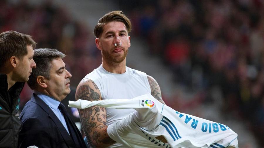 Sergio Ramos tiene fractura de tabique nasal