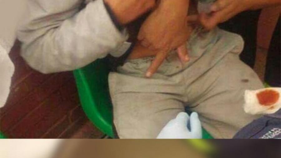 Alumno apuñala a compañero en escuela de Naucalpan 