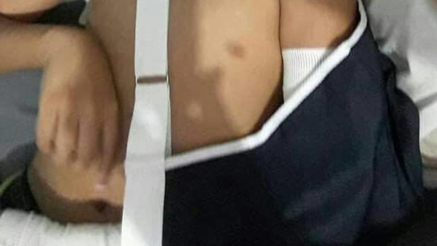 Compañeros de clase le fracturan brazo a alumno de escuela en Madero 