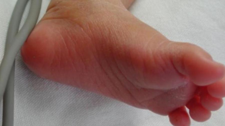 Muere bebé por sobredosis de marihuana
