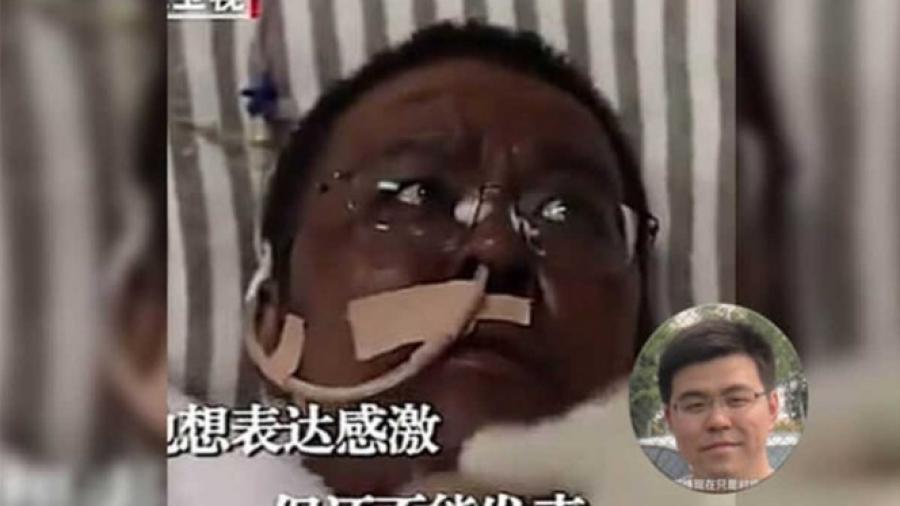 Muere médico en China cuya piel se oscureció a causa del tratamiento