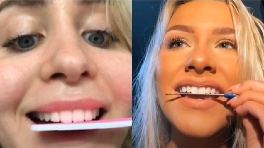 Limarse los dientes: la nueva ‘tendencia’ en Tik-Tok