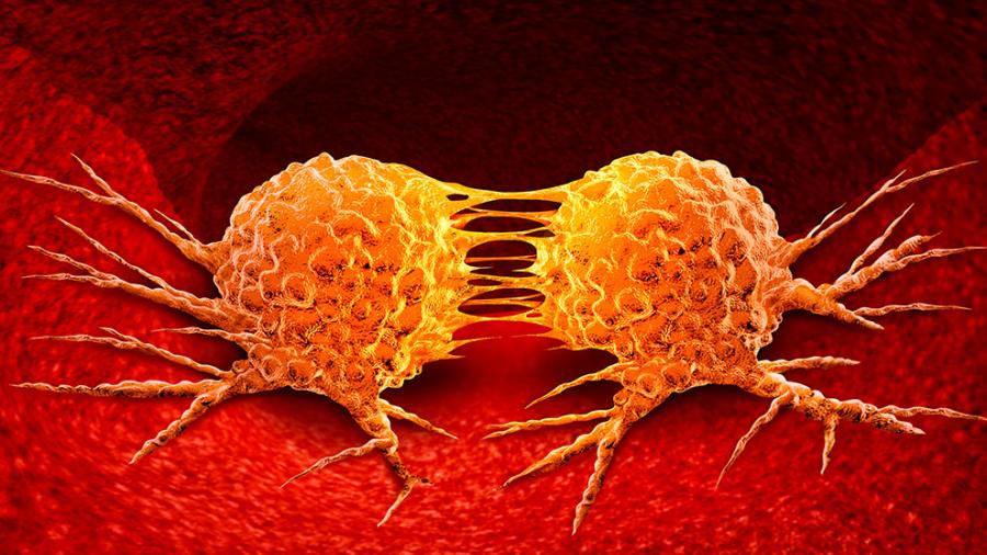 Encuentran gen que impide la metástasis en el cáncer 