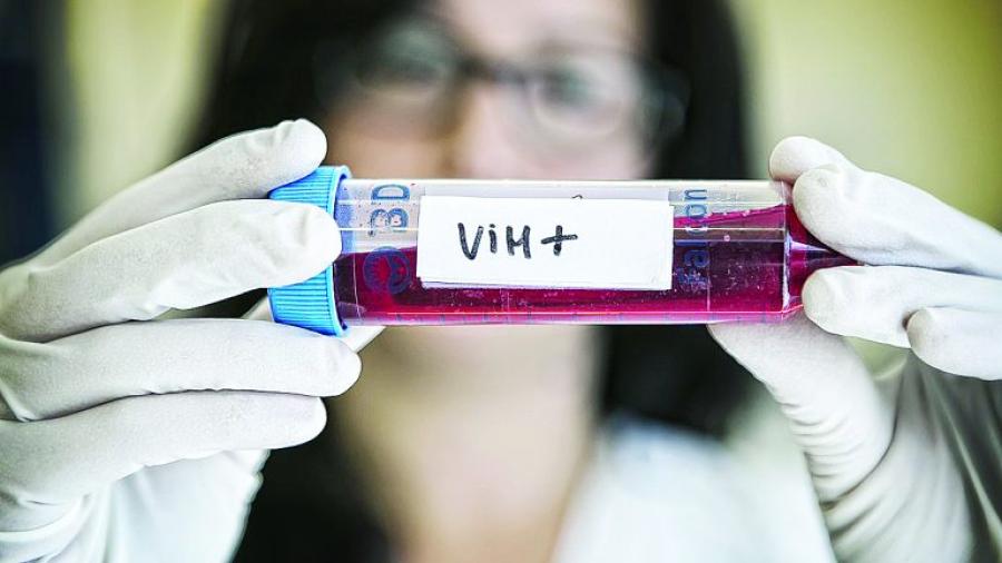 Confirman el segundo caso en el mundo de paciente curado de VIH