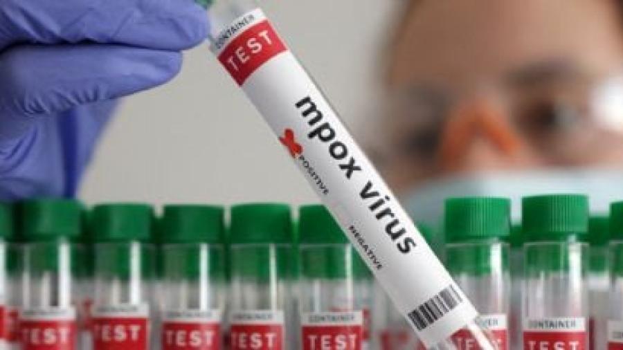 OMS mantiene la alerta internacional de emergencia sanitaria por mpox