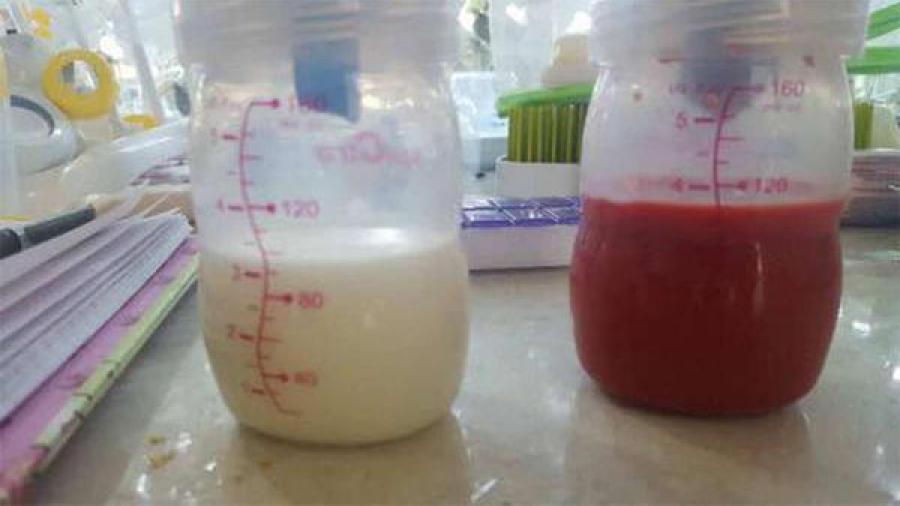 Mujer genera leche materna roja