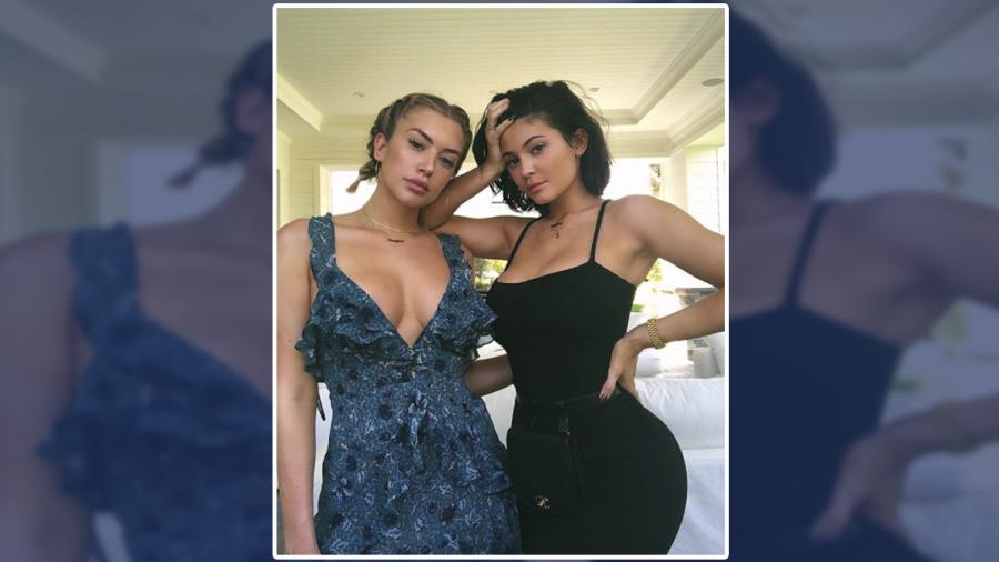 Kylie Jenner se quita el relleno de los labios